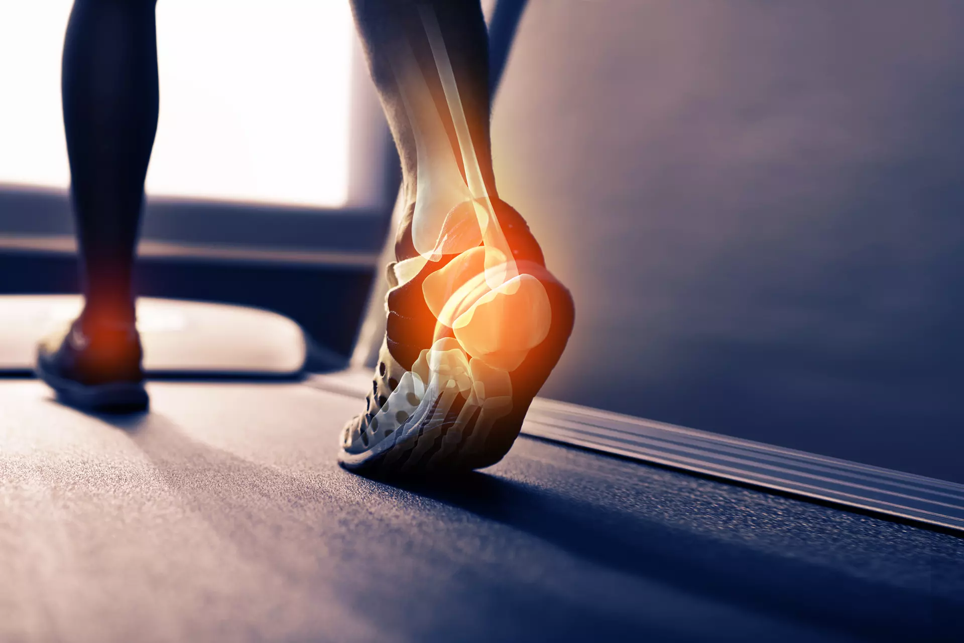 Bone Spurs