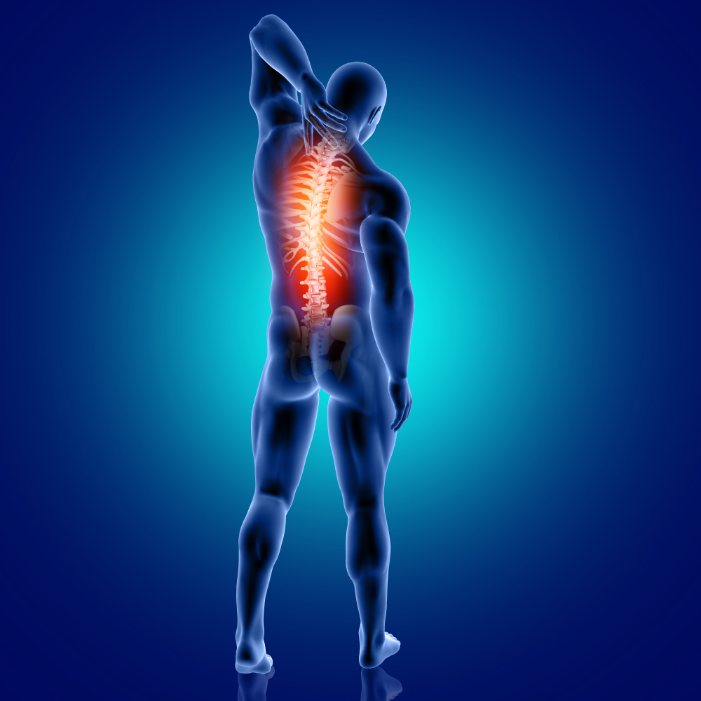 Vertebral Subluxation